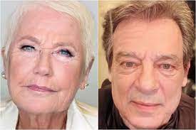 envelhecimento facial